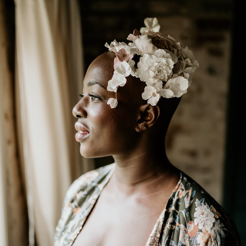 Bride with alopecia wearing a flower headpiece 